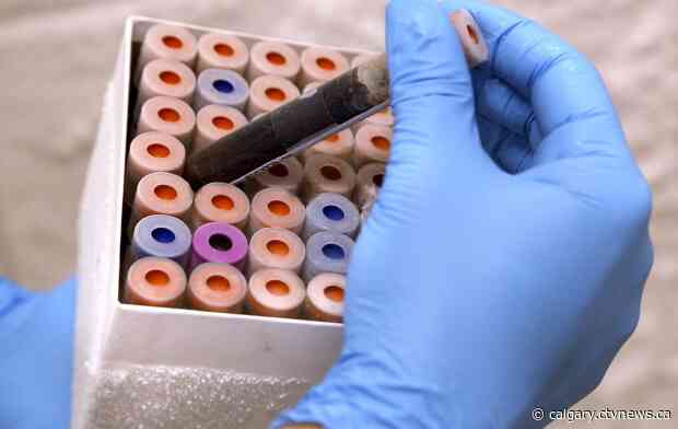 AHS seeks third-party companies to handle lab services