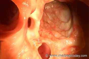 AGA Updates Best Practices for Colonic Diverticulitis