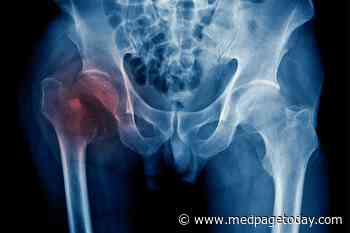 Long-Term Oral Bisphosphonates Get Little Love in Study