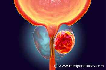 High-Risk Prostate Cancer Patients Can Wait 6 Months for Surgery: Study