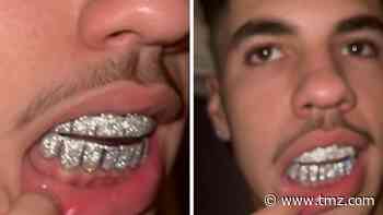 LaMelo Ball Cops Baller Diamond Grill With 14k Gold, Welcome To The NBA!