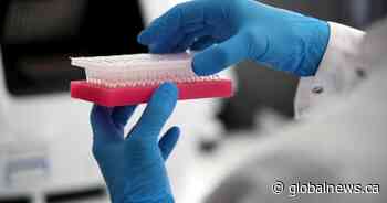 302 new coronavirus cases in Saskatchewan: Shahab