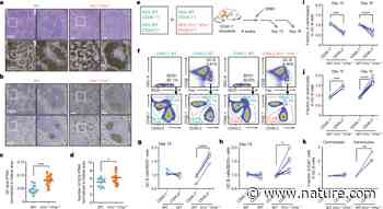 Histone H1 loss drives lymphoma by disrupting 3D chromatin architecture - Nature.com