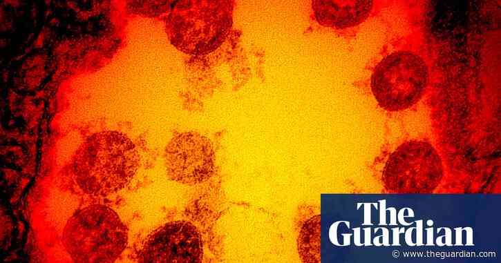 'Autoantibodies' may be driving severe Covid cases, study shows