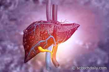 Sensor Can Detect Scarred or Fatty Liver Tissue to Help Prevent Liver Failure