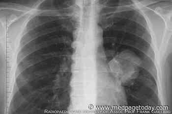 Clinical Challenges: ALK-Positive NSCLC