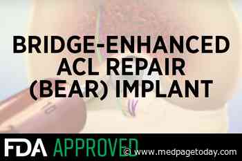 FDA OK's First-Ever Synthetic Implant for ACL Tears