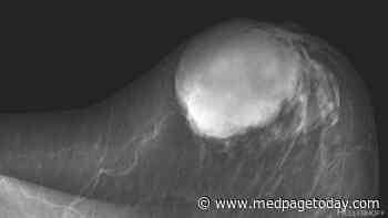 Surgery for Phyllodes Breast Tumors Varies Widely
