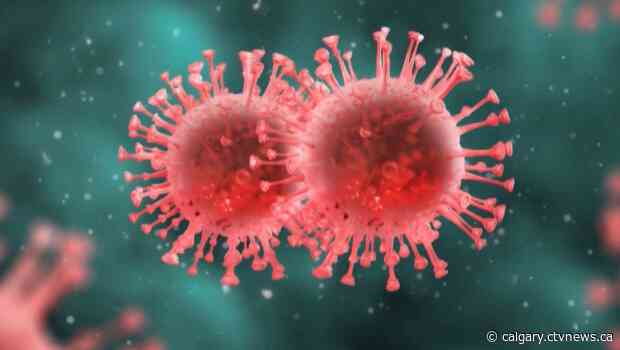 Woman in her 20s among 25 new COVID-19 deaths reported