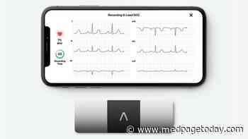 Op-Ed: Kardia Upgrade Will Cut Unclassified Mobile ECGs
