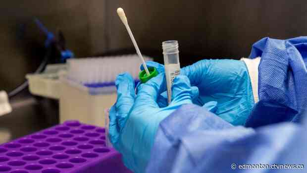 Alberta reports 1,286 new cases on Sunday; 19,201 residents with COVID-19 across province