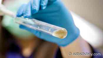 Bacterial Strain Uncovered for Producing Bioplastics From Sewage Sludge and Wastewater