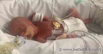 Derry tot born at just over 1lb sparks fundraising appeal - Belfast Live