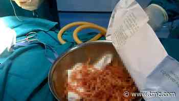 More Than 100 Parasitic Worms Removed from Man's Stomach