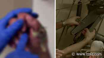 'Cake Boss' Buddy Valastro Shows Off First Look at Impaled Hand
