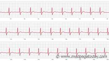 Op-Ed: How to Fix Consistently Inconclusive Apple Watch ECG Readings
