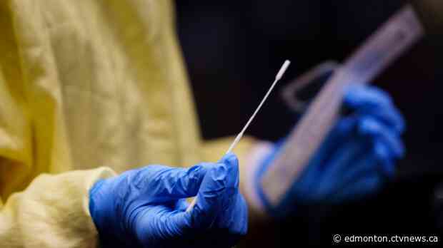 Alberta reports 500 COVID-19 cases on Sunday after low test numbers on Christmas Day