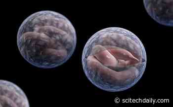 A Chain Reaction Led by Cells Lining the Intestines Sounds the Alarm When Parasites Invade