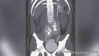 The strangest medical cases of 2020 - Livescience.com