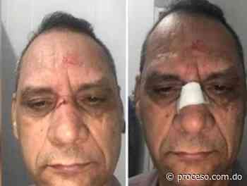 Violadores de toque de queda hieren coronel de una pedrada en el rostro - Proceso.com.do