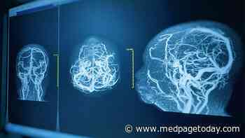 Thinning, Leaky Brain Blood Vessels Seen in COVID-19