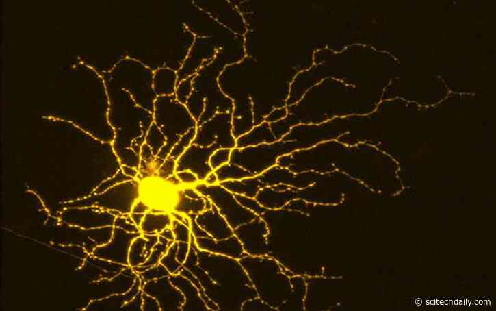 Treating Neurodegenerative Diseases From Glaucoma to Alzheimer’s: New Discovery on How to Protect Neurons and Encourage Their Growth