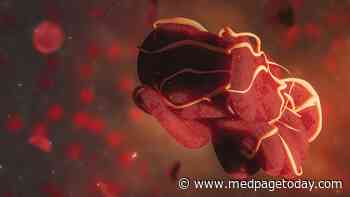 Staying Safe in Lupus: Monitor Hydroxychloroquine Levels