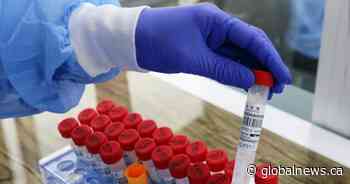 226 new coronavirus cases, 2 additional deaths reported in Simcoe Muskoka - Global News