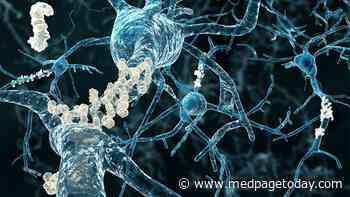 Novel Alzheimer's Drug Appears to Slow Decline