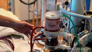 Covid-19: The machine that breathes for Covid patients