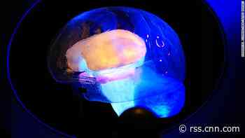 Brain implants: Restoring memory with a chip