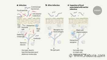 Food for thought about the immune drivers of gut pain - Nature.com