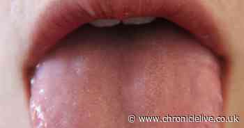 UK expert shares picture of increasingly common Covid-19 symptom to look out for