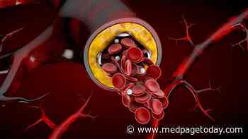 In STEMI PCI, Symptom-to-Balloon Time Is What Counts