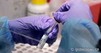 Coronavirus: 2 deaths, 94 cases in London-Middlesex as stay-at-home order takes effect