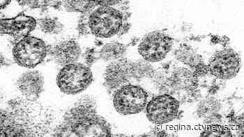 Sask. reports 312 new coronavirus cases, no deaths - CTV News