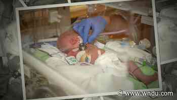 Medical Moment: Surgery during birth - WNDU