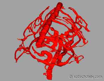 A Single Gene “Invented” Hemoglobin Several Times