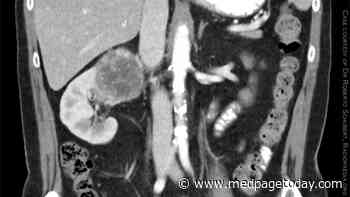 Why Did This Cancer Metastasize to the Pancreas?