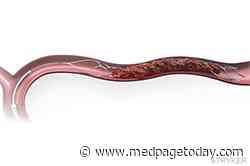 Hold the tPA on Some Thrombectomy Candidates, Trials Suggest
