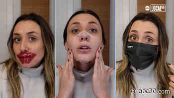 Winter skincare tips: How to battle 'Mask-Ne' and heal those chapped lips