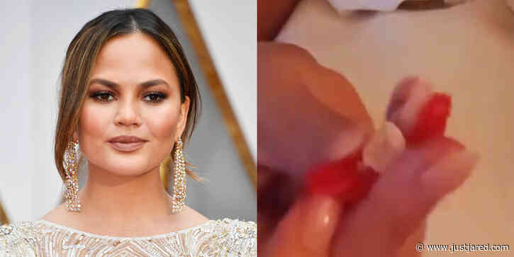 Chrissy Teigen Lost a Tooth While Eating a Fruit Roll-Up