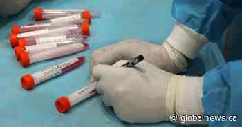 112 new coronavirus cases, 7 additional deaths confirmed in Simcoe Muskoka - Global News