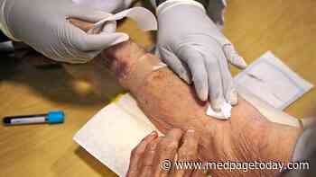 Game-Changer for Asymptomatic Alzheimer's Trials?