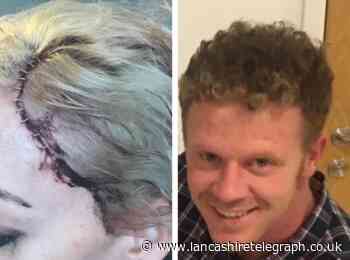 Victim of GBH attack by ex-partner horrified as he avoids prison