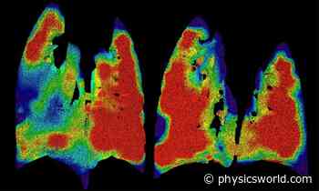Medical physics highlights of the year – Physics World - Medical Physics Web