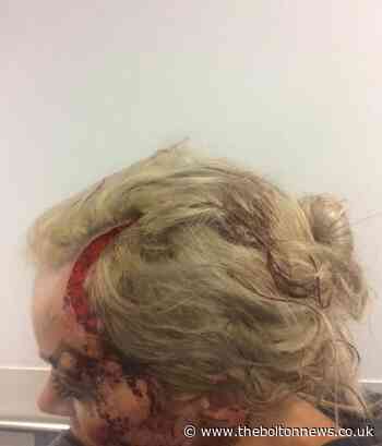 GBH victim feels 'failed' after suspended jail term for Ramsbottom ex-partner