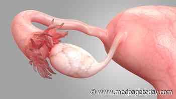 Wee1 Inhibitor Gets Win in Tough-to-Treat Ovarian Cancer