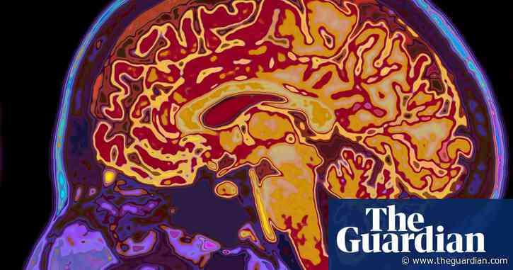 Covid linked to risk of mental illness and brain disorder, study suggests