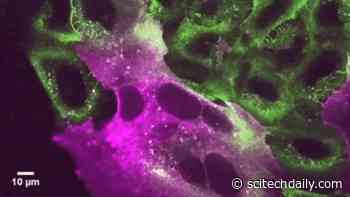 COVID-19 Virus Needs Cholesterol to Invade Cells – What This Means for People Taking Statins